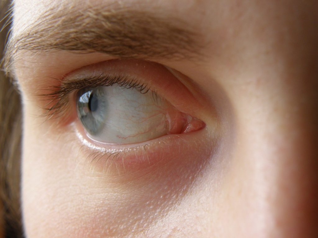 Blue eye - Lost at the Beauty Shop – A Story